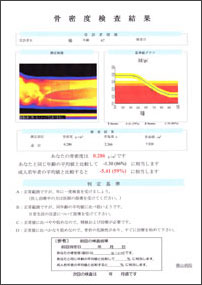 骨密度結果写真